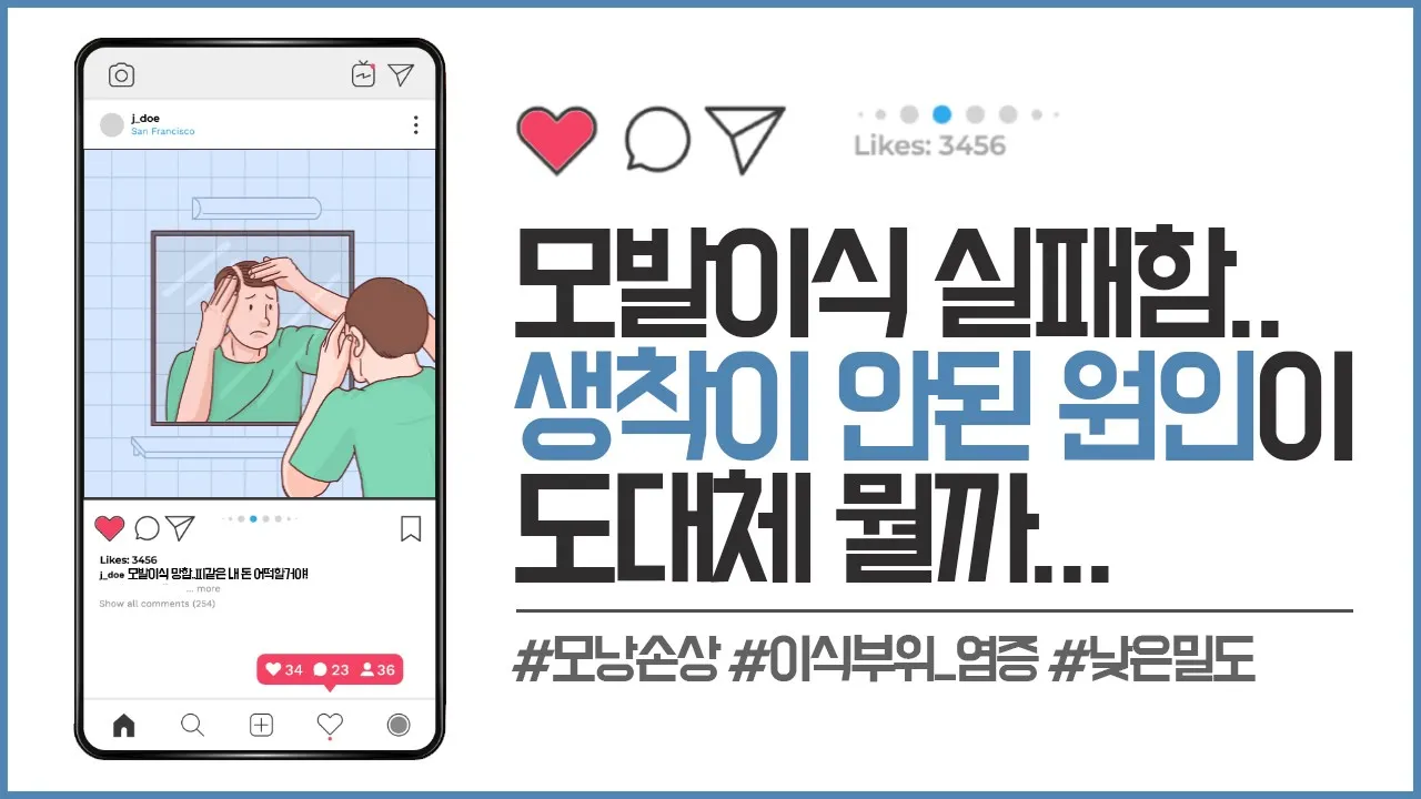 의느님답변📂ㅣ모발이식 실패의 원인과 적절한 생착률은 어떻게 될까요?! ㅣ모발이식 실패ㅣ모발이식생착률ㅣ다나성형외과(DANA)