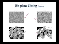 07 Lecture Chapter 3 Image Enhancement Last Part