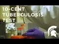10-Cent Tuberculosis Test
