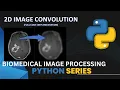 2d Image Convolution in Python Code implementation Biomedical Engineering