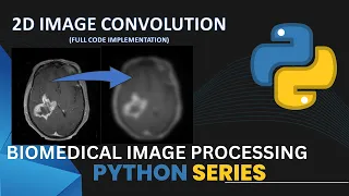 2d Image Convolution in Python Code implementation Biomedical Engineering