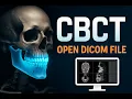 how to open DICOM file in CBCT software