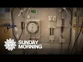 Kidney dialysis industry accused of maximizing profits over patients