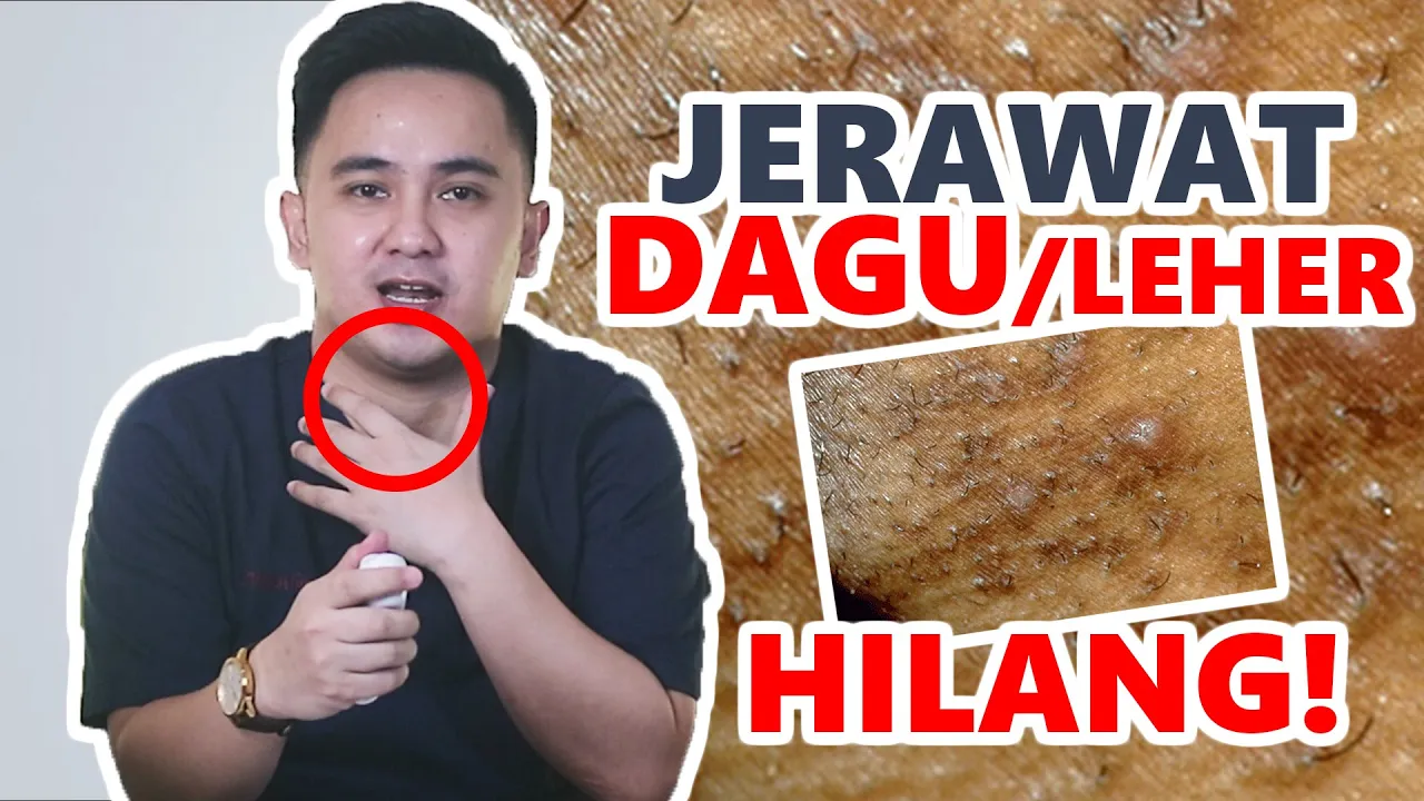 
          
          
          
            
            RAHASIA! Tips Menghilangkan JERAWAT LEHER secara alami
          
        . 