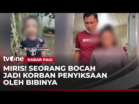 Petugas Kepolisian Menjenguk Dua Anak Korban Penganiayaan oleh Bibinya