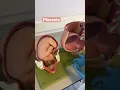Download Lagu Placenta previa #mbbs #medical #anatomy #pregnancy
