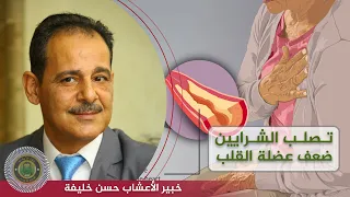 وصفات لعلاج تصلب الشرايين وضعف عضلة القلب مع خبير الاعشاب حسن خليفة 