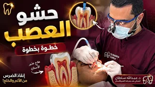 حشو العصب خطوة بخطوة 🦷 | كيف ننقذ جذر السن؟ | Root Canal Treatment Explained