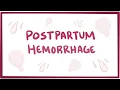 Postpartum hemorrhage - causes symptoms diagnosis treatment pathology