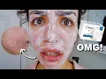 I USED DOVE SOAP ON MY FACE