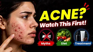 Acne Control Tips: Treatment, Diet & Skincare Explained! | Clear Skin Clinic, Pune