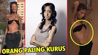 Tinggal Tulang Dan Kulit!! Inilah Deretan Orang Paling Kurus Di Dunia - SIDUL TUBE