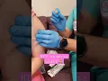 HPV AŞISI İLK DOZ 💉