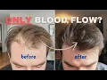 Does Blood Flow Increase Hair Growth