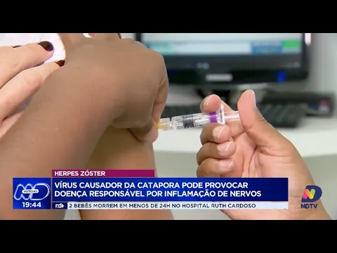 Herpes zóster: vírus causador da catapora pode provocar doença responsável por inflamação de nervos