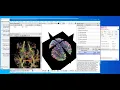 NIFTI file to Tractography in 2 minutes