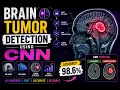 Brain tumor detection using convolutional neural networks