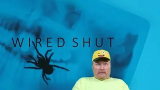wired shut movie review