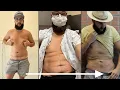 Male Liposuction and Chest Reduction Michael s Gynecomastia and Fat Loss Review with Sono Bello