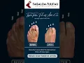 Tired of Hammertoe Pain Holding You Back