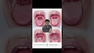 دكتور طارق الفهد و هل تستطيع ان ترى لسان الموت    دندنها