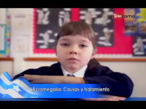 Acromegalia: Causas y tratamiento