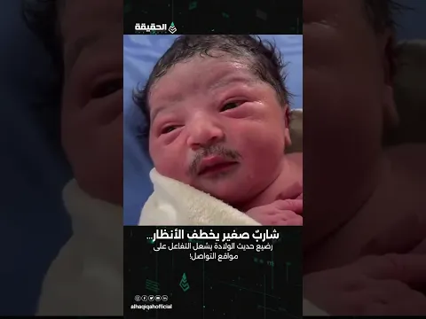 خطف الأنظار رضيع حديث الولاده بشارب!!