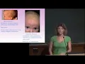 Emma Holliday Pediatrics W Her PP Slides High-Yield USMLE Step PP Download Link Below Shelf Exam