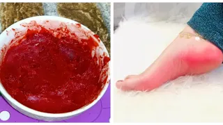 تنعيم وتوريد القدمين كريم كعب الغزال ب مكونات بس وكمان رئحه عطره دندنها