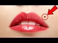If You Have Moles on One of These Places It Has Surprising Meaning
