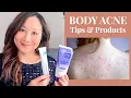 How to treat BODY ACNE - Back Chest More Dr Jenny Liu
