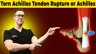 Download Torn Achilles Tendon Rupture or Achilles Tendonitis [HOW TO TELL] MP3