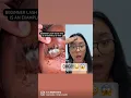 Download Lagu EYE INFECTION FROM LASH EXTENSIONS?!?