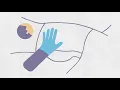 How To Give A Suppository Or Enema