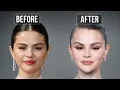 Lagu Selena Gomez’s Plastic Surgery Tells a Story… and It’s Not What You Think ​