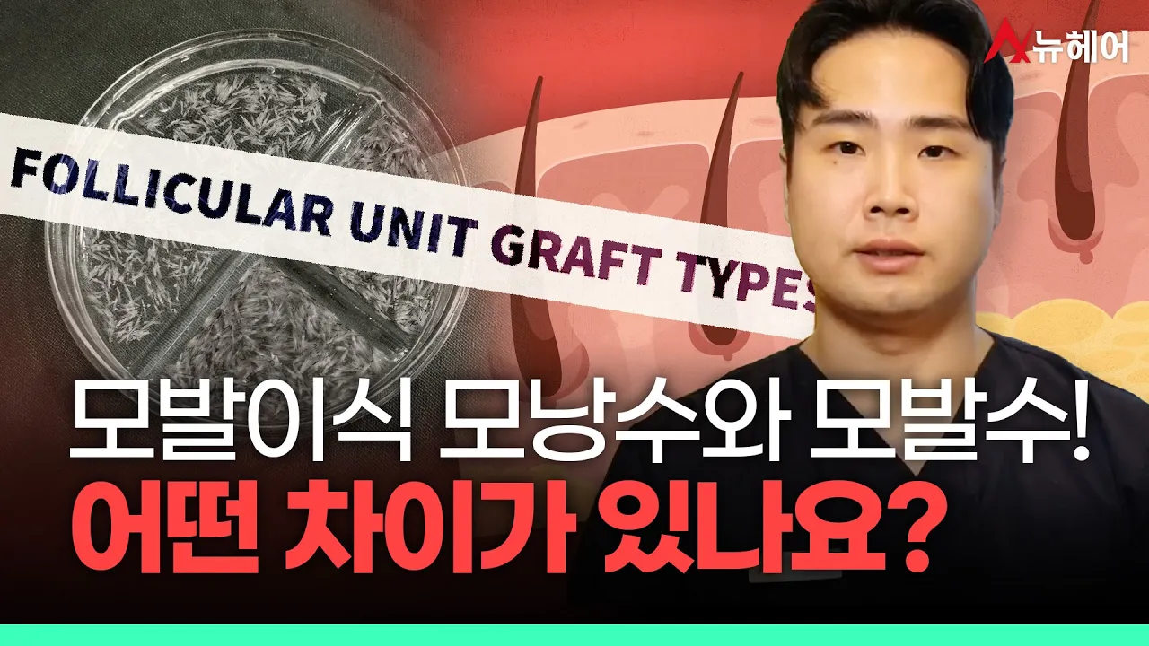 모발이식해야 하는데 '모낭수'와 '모발수' 뭐가 다른 거지?ㅣ뉴헤어