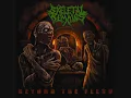 Skeletal Remains - Traumatic Existence