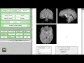 SPM Tutorial Looking at the Data