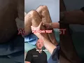 Download Lagu Quick DIY ACL Tear Test 🦵 Try at Home! #shorts