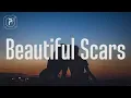 Download Lagu Maximillian - Beautiful Scars (Lyrics)