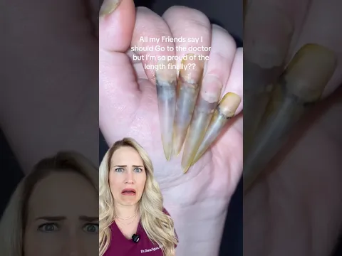 What happened to her nails?!