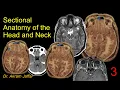 Sectional Anatomy of the Head and Neck Part 3