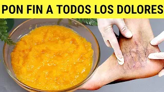 Frota esto en tus VARICES🦵Esta receta disuelve tus VENAS VARICOSAS (arañitas) 100% Efectivo