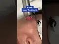 Download Lagu Laser ASMR #shorts