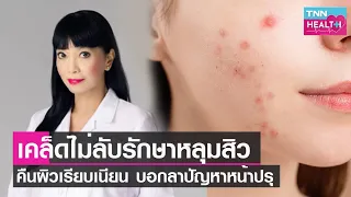 หลุมสิวสามารถกลับมาเรียบเนียนเหมือนเดิมได้หรือไม่ และมีวิธีการรักษาอย่างไรบ้าง