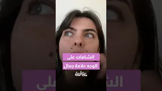 احكيلنا عندك شامات بالوجه    دندنها