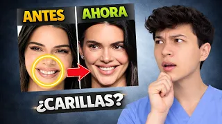 ¿Carillas o natural? Analizo la sonrisa de las Kardashian/Jenner (ANTES vs AHORA) 😳