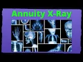 Variable Annuity Good or Bad - Fees Explained