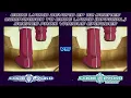 Download Lagu CODE LYOKO BEYOND - EP112 vs OFFICIAL SHOW