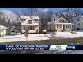 Fort Dodge dog attack victim has legs amputated will need facial reconstruction surgery